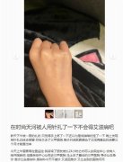 两网友自称在广州街头被人扎针，出于害怕已到